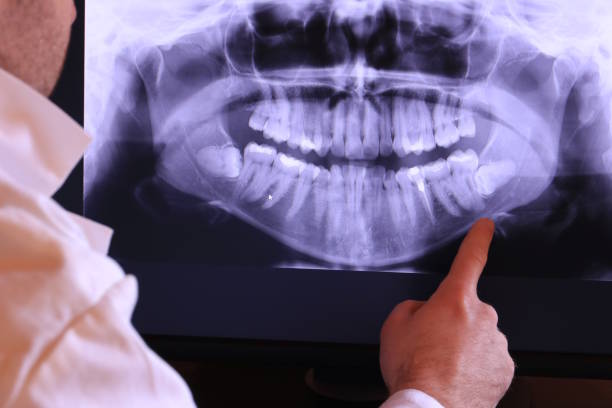 Emergency Dentist for Kids in CT